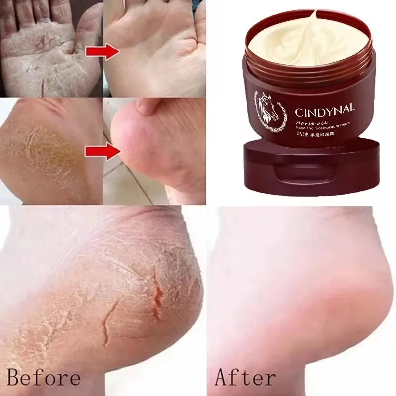 Kit Pédicure Maison – Soin Complet Talons & Pieds