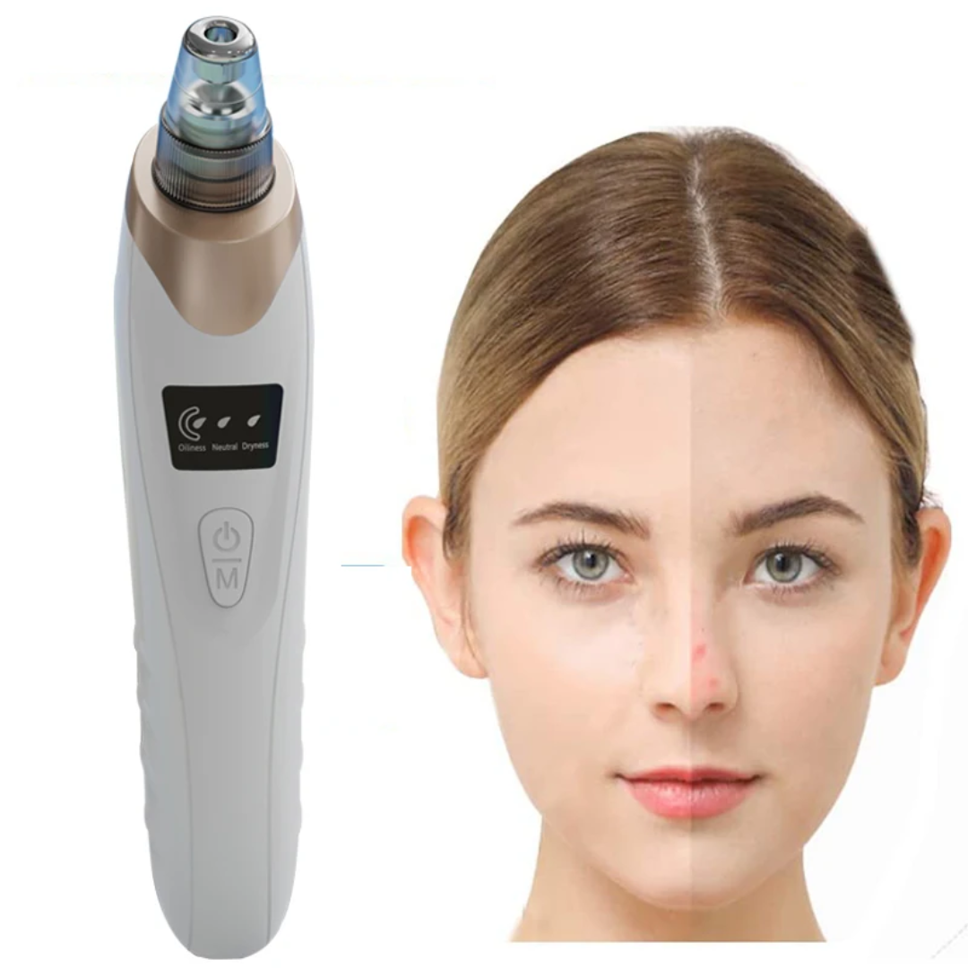 Aspirateur de Points Noirs Professionnel – Peau Nette à Domicile